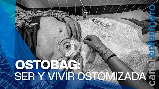 quotOstobag ser y vivir ostomizadaquot la realidad de los pacientes ostomizados [upl. by Naro]