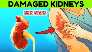 9 Skin Signs That May Indicate Your Kidneys Are Damaged [upl. by Neirda546]