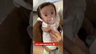 Nebulisation of 1 year old cute baby ❤️❤️🥹cutebaby reels babyshorts viralshorts [upl. by Heller]