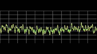 Kidney Diseases  Rife Frequencies [upl. by Fuller943]