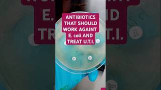 The antibiotics are AMIKACINAK MEROPENEMMEM CIPROFLOXACINCIP TAZOBACTAMTZP AND GENTAMICINCN [upl. by Esojnauj]