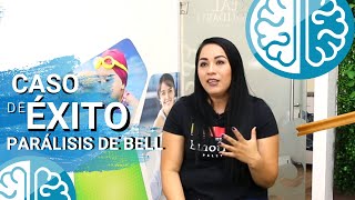 TRATAMIENTO de PARALISIS de BELL ► ¿Qué ejercicios hacer 😚¡CASO DE ÉXITO Fisioterapia Guadalajara [upl. by Sarine]