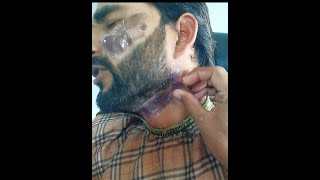 Hair remove hair wax funny video [upl. by Hepzi]