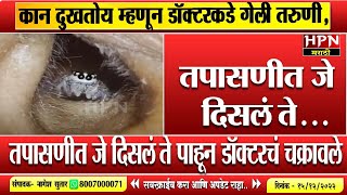 कान दुखतोय म्हणून डॉक्टरकडे गेली तरुणीतपासणीत जे दिसलं ते  Viral Video  Hpn Marathi News [upl. by Storz422]