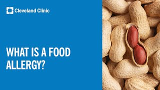 What Is a Food Allergy [upl. by Ninnetta364]