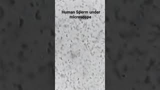 Semen Analysis  Human Spermatozoa sperm under microscope  Pathology [upl. by Loraine]