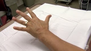 Mayo Clinic Minute What may be causing your hands and feet to tingle [upl. by Olegnad]