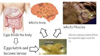 Neurocisticcircosis symptoms and treatment Why is pork tapeworm so dangerous [upl. by Kcirderf456]