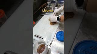 Lipoma tissue grossing  histopathology [upl. by Joane206]