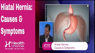 Hiatal Hernia Causes amp Symptoms [upl. by Edijabab]