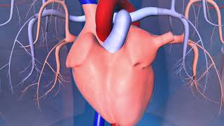 Catheter Ablation What is it and how does it help an irregular heart beat [upl. by Torrell]