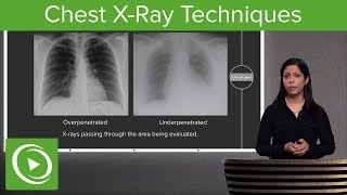 Chest XRay Techniques Inspiration Penetration Rotation – Radiology  Lecturio [upl. by Cecile]