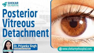 What is Posterior Vitreous Detachment What are its symptoms  Shekar Eye Hospital [upl. by Magnum]