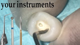 Premolar Access Cavity preparation [upl. by Ahse349]