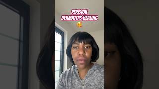 Perioral dermatitis home remedies perioraldermatitis dermatitis naturalskincare I’m almost healed [upl. by Sirromal]