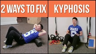 2 ways to help fix stubborn kyphosis hunchback posture [upl. by Jude292]