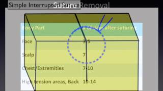 Suture Removal A Video for Patients [upl. by Bink]