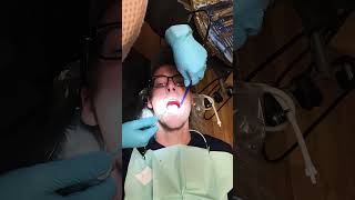 👀Dental Suction ASMR  Teeth Cleaning Near Me👂🙉 [upl. by Krall290]