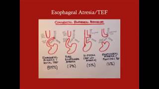 Surgical Problems of the Neonate  CRASH Medical Review Series [upl. by Klug]