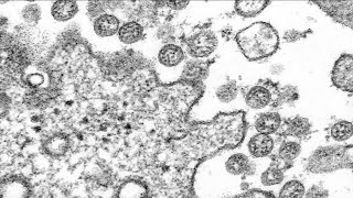 Colorado officials identify first known US case of COVID19 variant seen in UK [upl. by Adah]