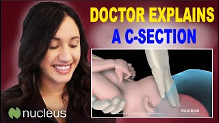 Doctor Uses 3D Animation to Explain CSection [upl. by Arehsat]