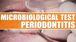 PERIODONTAL TREATMENT UK  Microbiological Test  Periodontitis [upl. by Enaile]