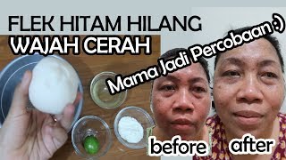 Masker alami untuk menghilangkan flek hitam dengan Bengkoang Review Velrose Secret [upl. by Aixela]