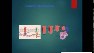 pathology  Hematology  dr Tahseen  Hemolytic Anemia  Spherocytosis [upl. by Yessak]