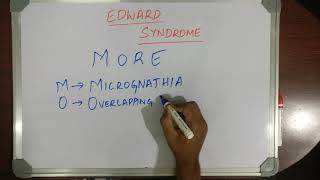 MEDICAL MNEMONIC POCKET EDWARD SYNDROME [upl. by Anaoj]