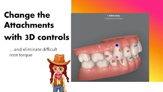 Invisalign ClinCheck  Changing attachments with 3D controls [upl. by Ratna]