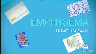 EMPHYSEMA  COMPLETE DISCUSSION  MCQs [upl. by Fleur]