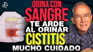 SI TIENES ORINA CON SANGRE Y Te Arde Tienes Que Ver Esto  Oswaldo Restrepo RSC [upl. by Lamaj]