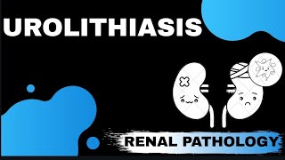 UROLITHIASIS  Renal pathology  Med Bees [upl. by Rosa]