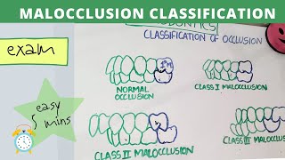 malocclusion of teeth I orthodontics lecture [upl. by Elitnahc]