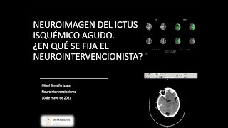 Neuroimagen del ictus isquémico agudo ¿En qué se fija el Neurointervencionista [upl. by Aneloaup]