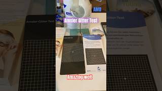 Amsler Gitter Test [upl. by Sivar847]