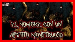 El Hombre Con Un Apetito MONSTRUOSO Documental Tarrare [upl. by Nosrac]