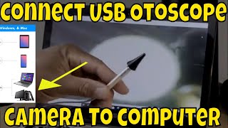 How to connect USB Otoscope Ear Scope Camera To computer [upl. by Cesaro]