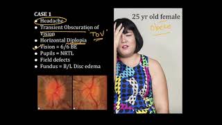 High Yield Topic  Papilledema  A Complete Review [upl. by Server]