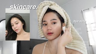 how i cleared my ACNE  my skincare routine affordable [upl. by Neruat]