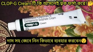 ClopG Cream এর কাজ কিদাম সহ জেনে নিন ব্যবহার করার নিয়ম  ফর্সা হওয়ার ক্রিম  ClopG Cream Review [upl. by Nnayllas629]