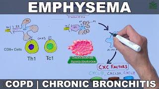 Emphysema  COPD [upl. by Blount]