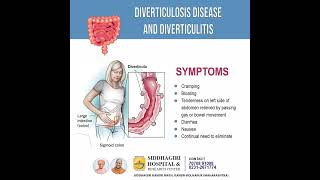 Diverticulosis Disease and Diverticulitis  Symptoms [upl. by Filberte]