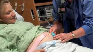 Maternity Fetal Monitoring [upl. by Ajuna]