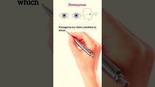 Nystagmus 🩺 Medical terminology medical medicalterminology youtubeshorts shorts live [upl. by Jackquelin]