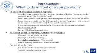 How to handle cataract surgery complications the vitreoretinal surgeons point of viewt [upl. by Pam]