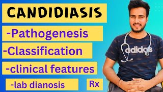 Candidiasis microbiologypathogenesislabdiagnosisTreatment [upl. by Bonucci]