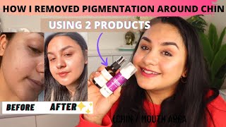 How I Reduced Pigmentation Around My ChinMouth By Using Only 2 Products [upl. by Ragnar]