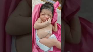 Newborn baby with a big caput due to obstructed labour📽️shortsshortsfeedshortvideotrendingbaby [upl. by Aenad]