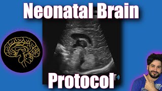 Neonatal Brain Protocol [upl. by Nivle]